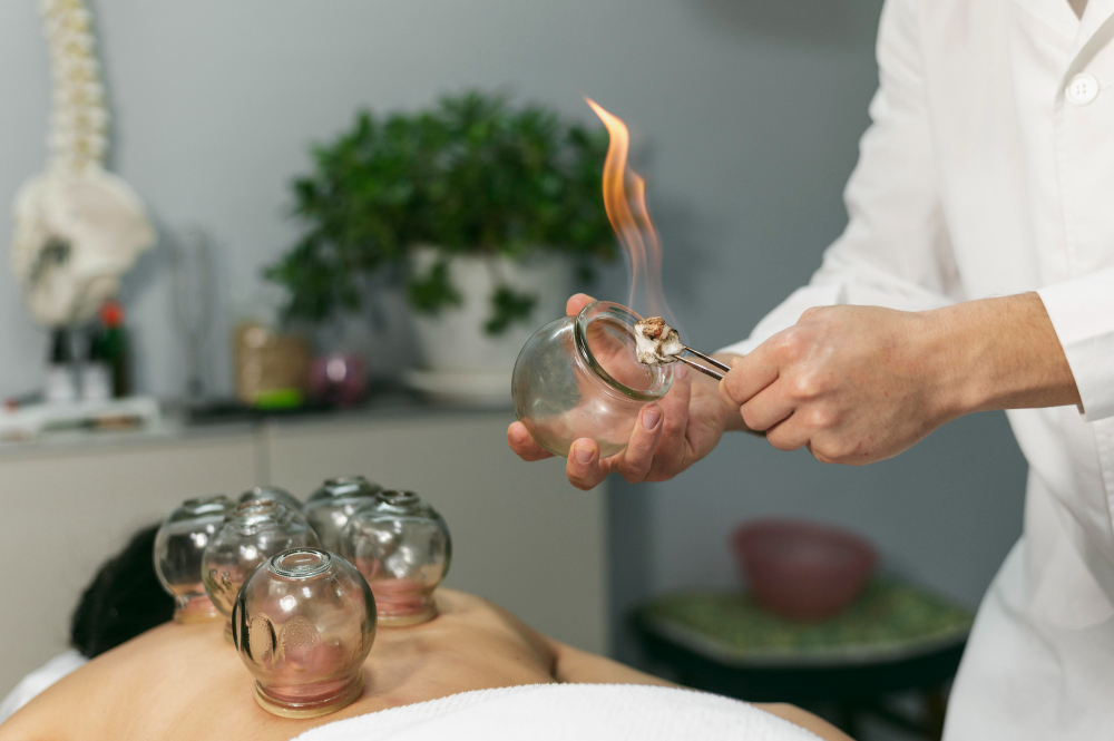 Acupressure/ Acupuncture