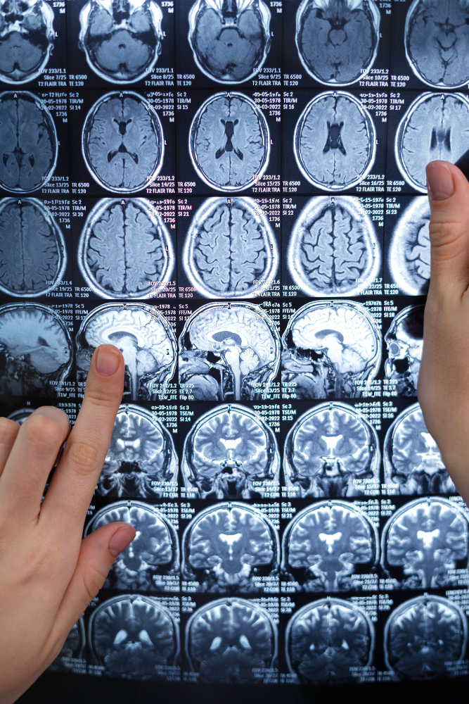 About Image